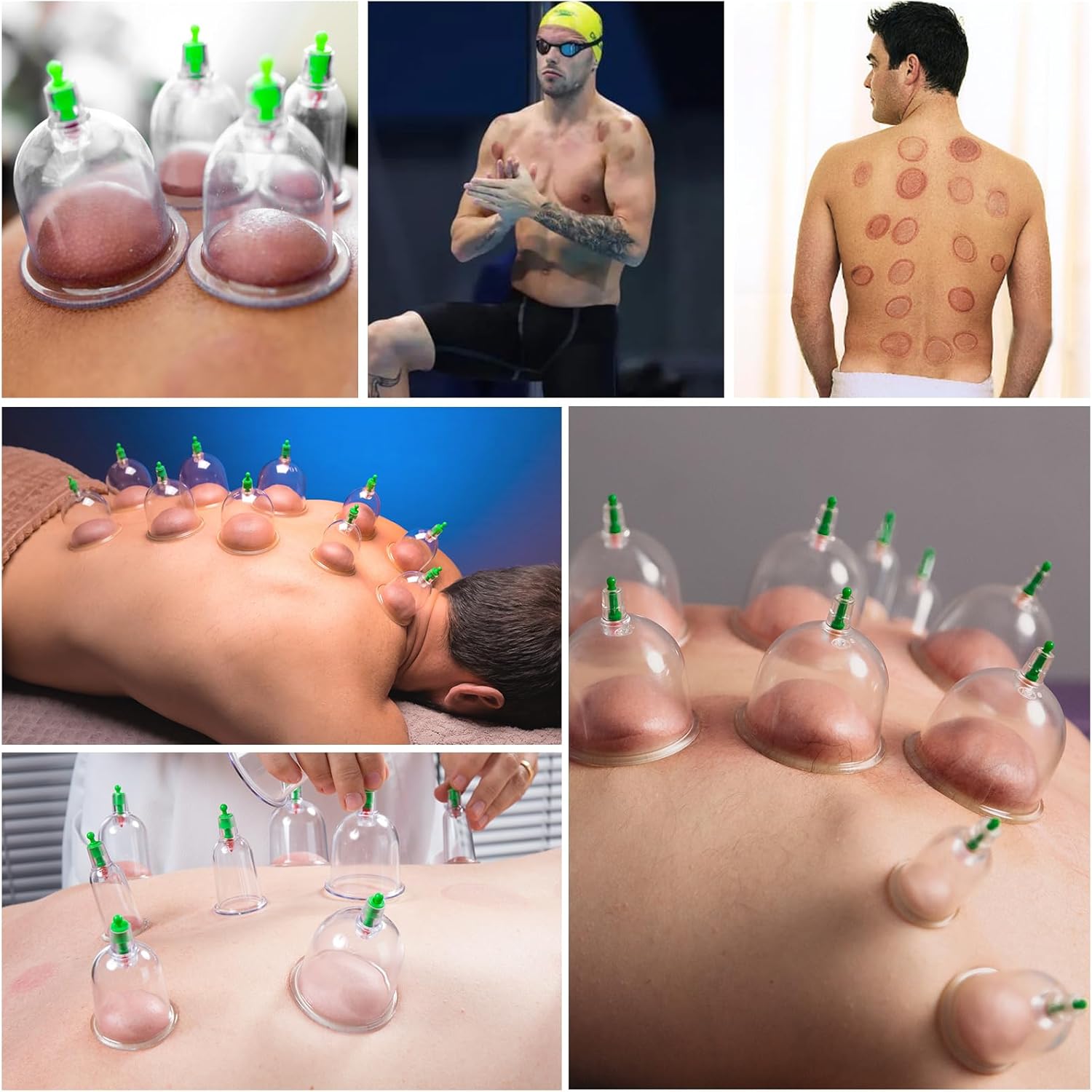 Elektrické čínske masážne vákuové banky - set